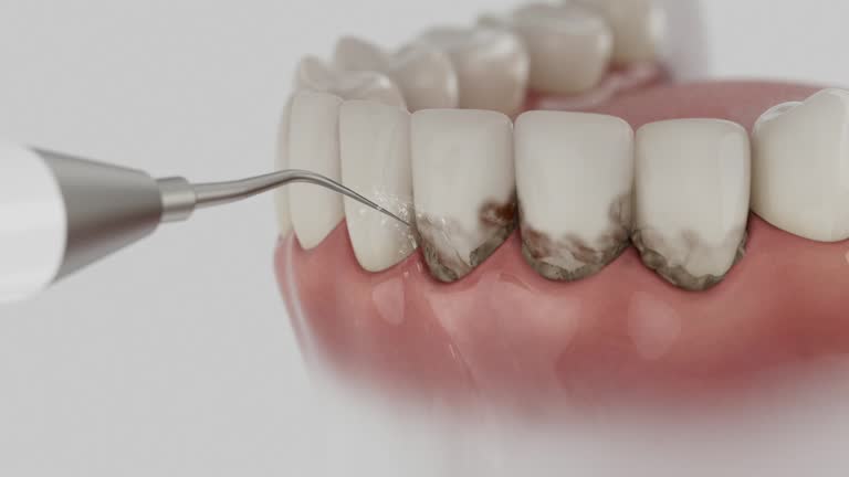 Reliable Emergency Dentist contractor in Toftrees, PA by Smile Center Dentistry